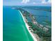 Aerial view of the neighborhood near the Gulf; walk to the beach from these condos at 9393 Midnight Pass Rd # 201, Sarasota, FL 34242