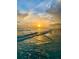 Calm beach scene with gentle waves rolling in under a sunny sky, offering a relaxing view at 845 Benjamin Franklin Dr # 101, Sarasota, FL 34236